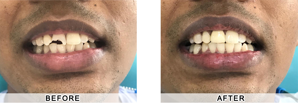 dentist patient1
