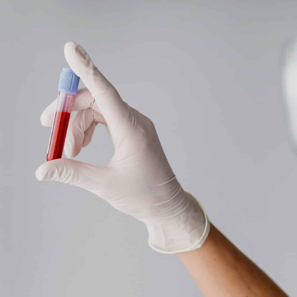 Confidential STD Check-up in Dubai by Cosmocare Medical Center
