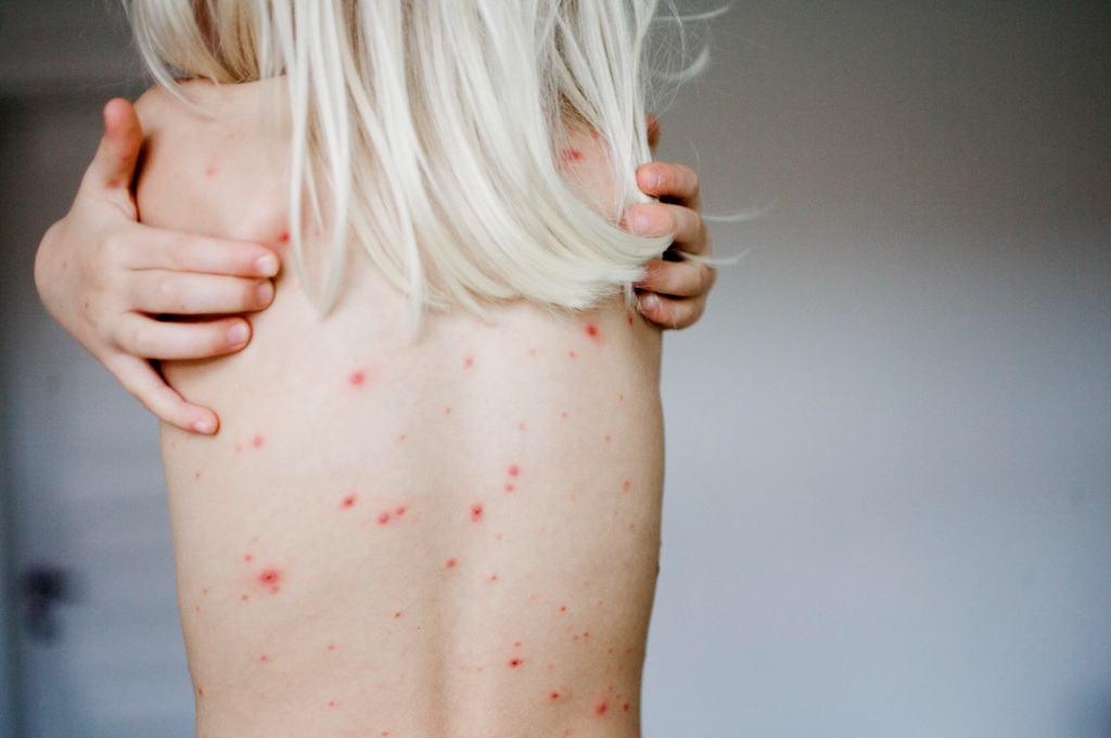 gonorrhea treatment